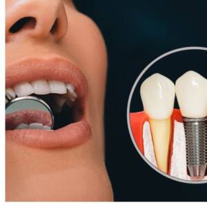 implante dentista alaquas