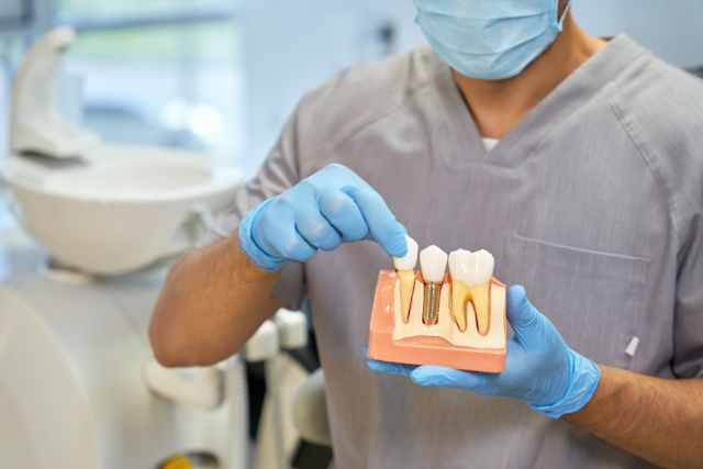 La importancia de un implante dental para una buena salud bucal