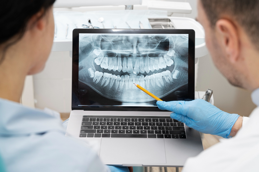 Tratamiento de implantología: Radiografía