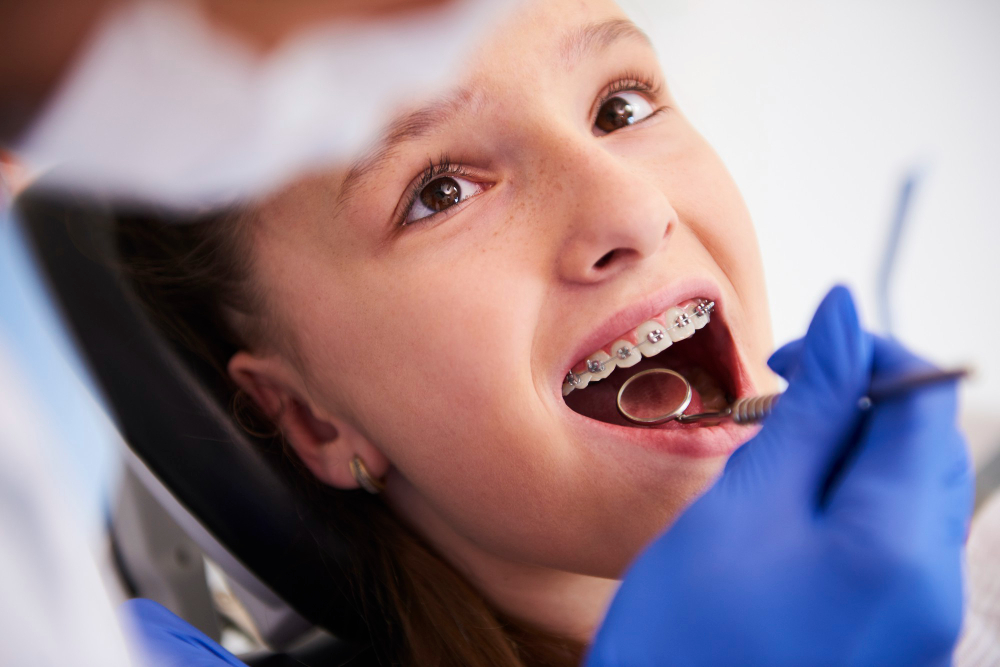 Tratamiento de ortodoncia: Ortodoncia infantil