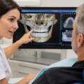 Qué son los implantes cigomáticos y para quién están indicados
